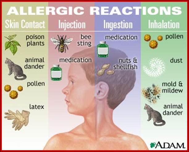 http://adam.about.com/b/a/allergy.jpg