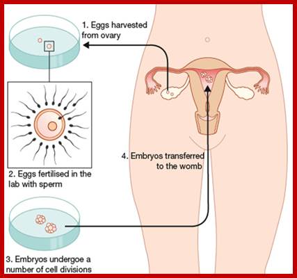 Image result for Human in vitro fertilization